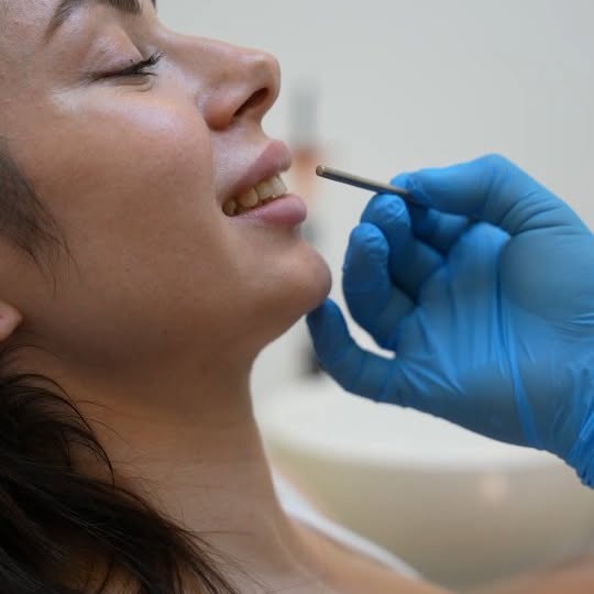 Confidence starts with a smile. Discover the beauty of laminate veneers. 💫 . . . . . #emax #laminateveneers #zircadpirme #ivoclar #dentaltreatmentturk
