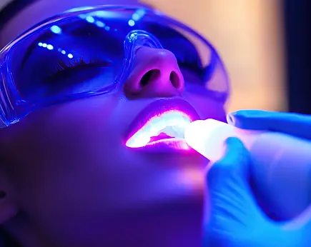 Teeth Whitening