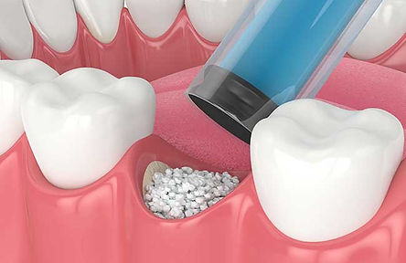 Surgical Procedures